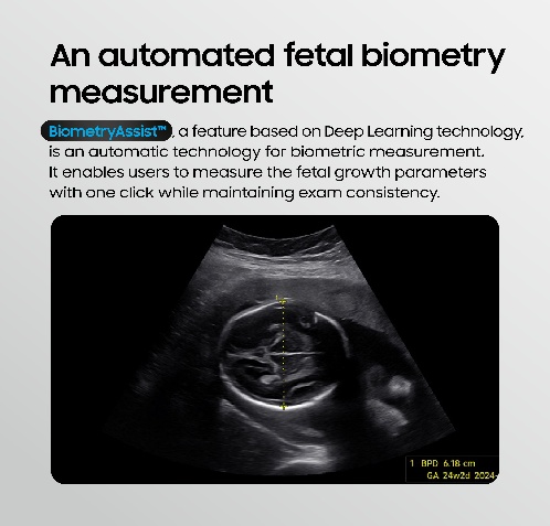 BiometryAssist automated fetal biometry measurement