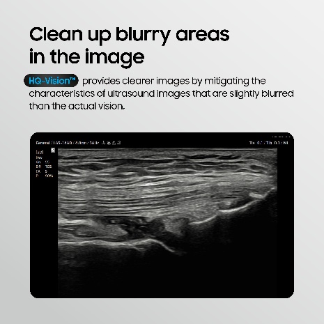HQ-Vision cleaning up blurry areas in the image