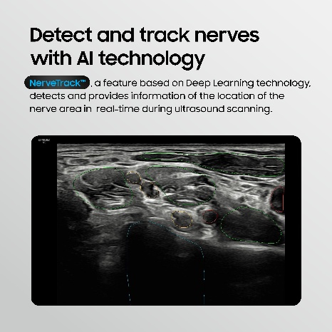 NerveTrack detecting and tracking nerves with AI