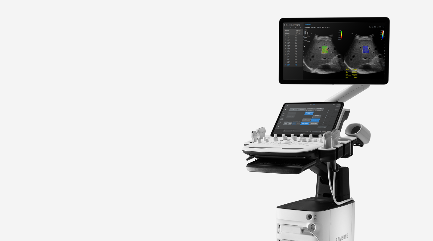 Samsung V5 ultrasound system